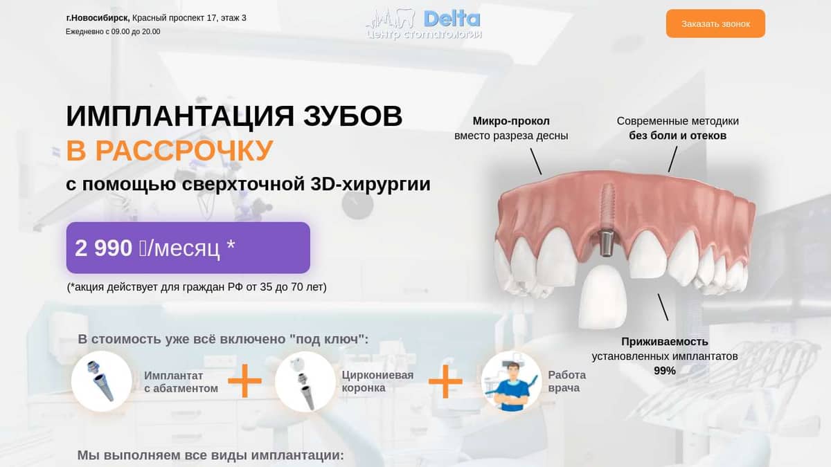 Имплантация зубов в Новосибирске в рассрочку